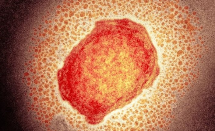 DSÖ: Maymun çiçeği virüsü vakaları artabilir