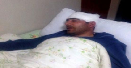 Ağrı'da Ak Partili akrabalar kavga etti: 2 Yaralı