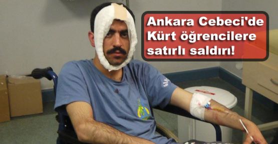 Ankara Cebeci'de Kürt öğrencilere  satırlı saldırı!