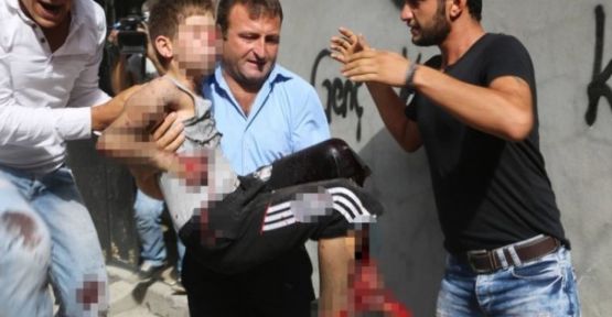 Cizre'de patlama: 12 yaşındaki çocuğun eli koptu