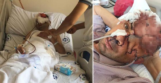 Dişini çektirdikten sonra gözünü ve yüzünün bir kısmını kaybetti iddiası