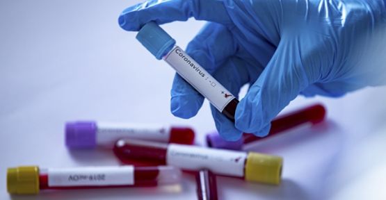 Dünyada koronavirüs vaka sayısı 837 bin 86’ya, can kaybı ise 44 bin 249’a yükseldi