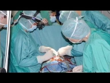 Dünyanın ilk yapay kalbi 2,5 ay yaşattı