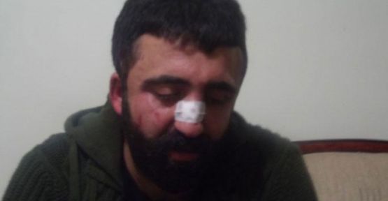 Erzurum'da öğrencilere ırkçı saldırı: 2 yaralı