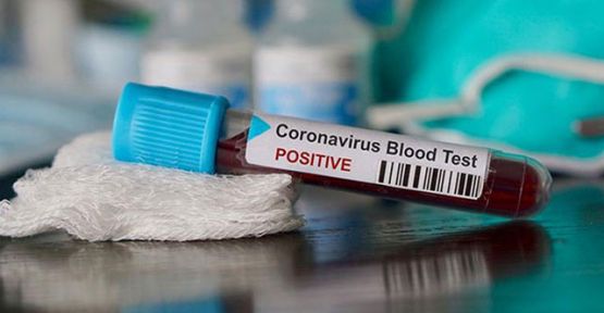 İngiltere'de son 24 saatte koronavirüsten 761 ölüm