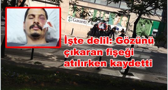 İşte delil: Gözünü çıkaran fişeği atılırken kaydetti