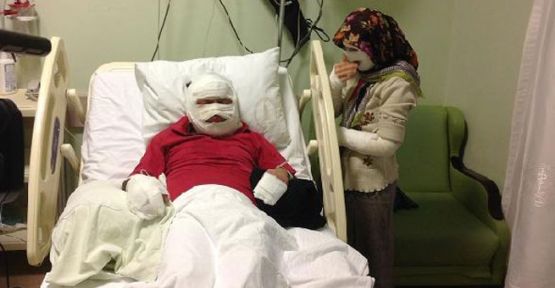 Karı- kocayı oda spreyi bu hale getirdi