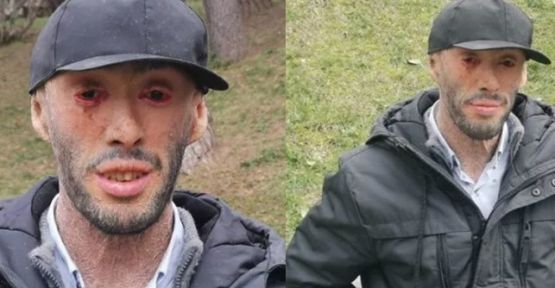 Şemdinlili Refik Töre, hayırseverlerden destek bekliyor