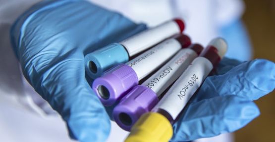 TTB: İstanbul'daki hasta sayısı 2 binin üzerinde