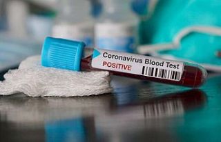 Covid'de ölüm riskini hesaplayan test geliştirildi