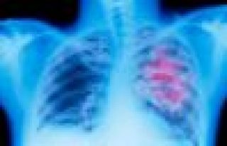 Akciğer kanseri olan hastaların ilaç parası için...
