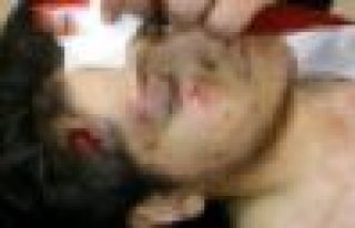 Berkin'in öldüğü gün biber gazı fişeğiyle...