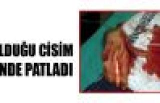 Bulduğu cisim elinde patladı: 1 yaralı