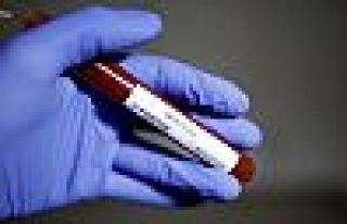 Covid-19 salgını: Türkiye'da vaka sayısı 100...