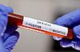 Covid-19 salgını: Türkiye'de 20 kişi daha öldü