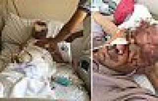 Dişini çektirdikten sonra gözünü ve yüzünün...