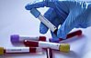 Dünyada koronavirüs vaka sayısı 837 bin 86’ya,...