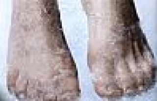 Dünyanın dondurulan ilk insanı 50 yıldır beklemeye...