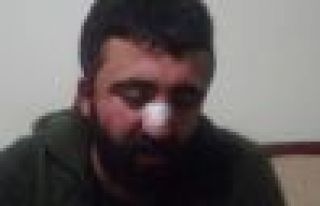 Erzurum'da öğrencilere ırkçı saldırı: 2 yaralı