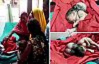 Hindistan'da üç başlı bebek doğdu