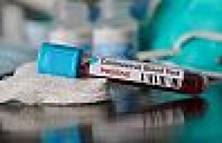 İngiltere'de son 24 saatte koronavirüsten 761 ölüm