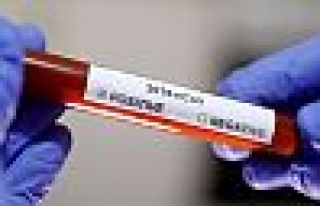 Virüsü 'en iyi tanıyan' kişi KHK ile ihraç edilmiş